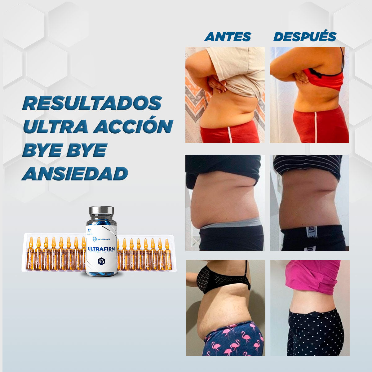 Tratamiento Ultra Acción: Bye Bye Ansiedad