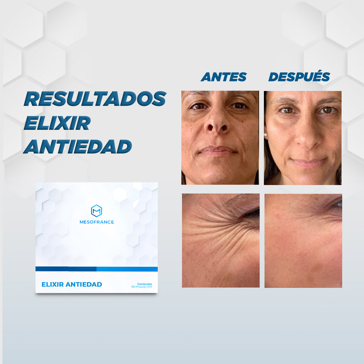 Tratamiento Elixir Antiedad