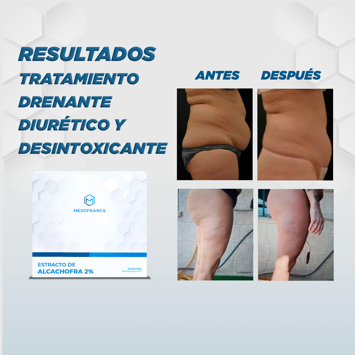 Tratamiento Drenante, Diurético, Desintoxicante