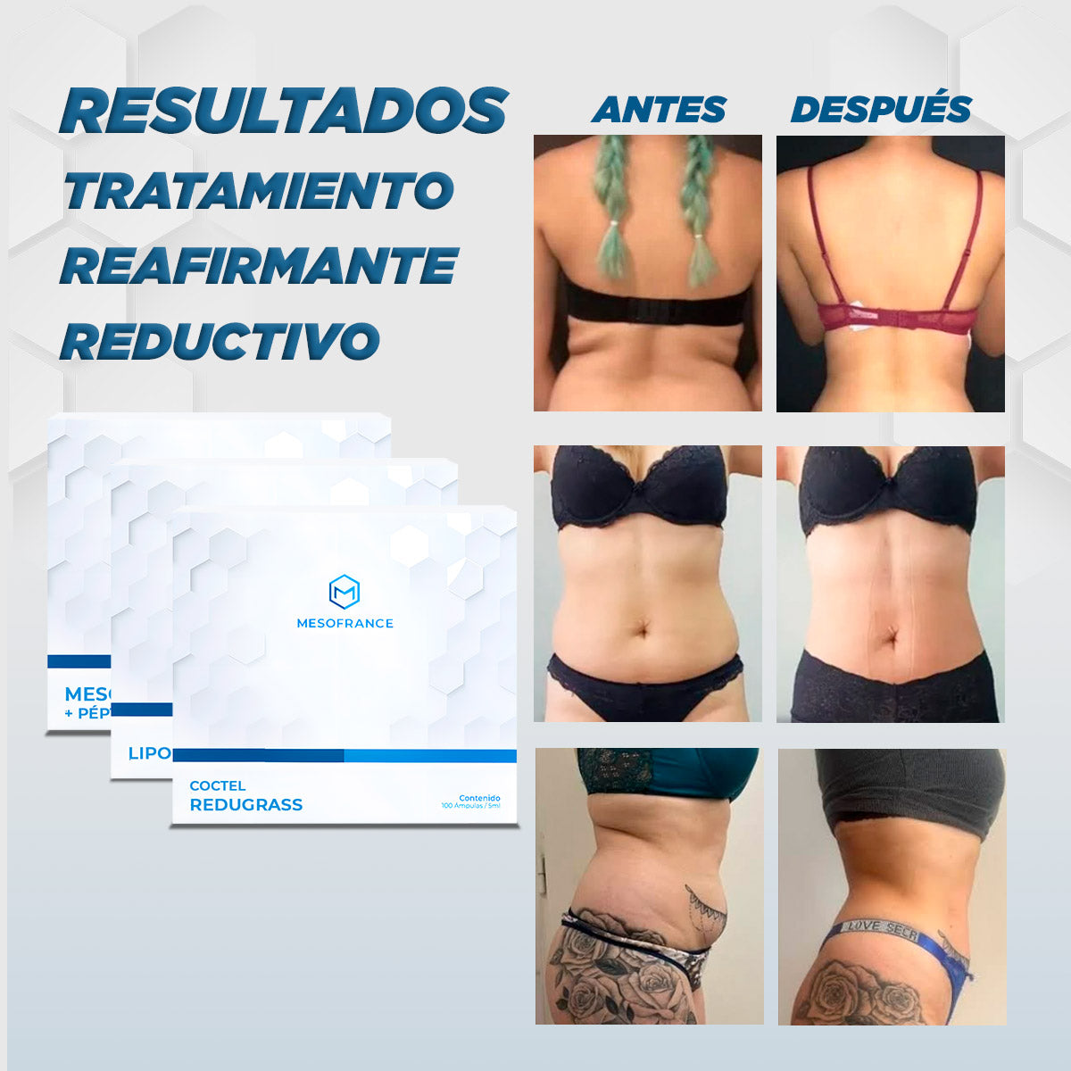 Tratamiento Reductivo-Reafirmante
