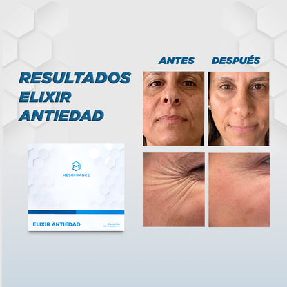 Tratamiento Elixir Antiedad