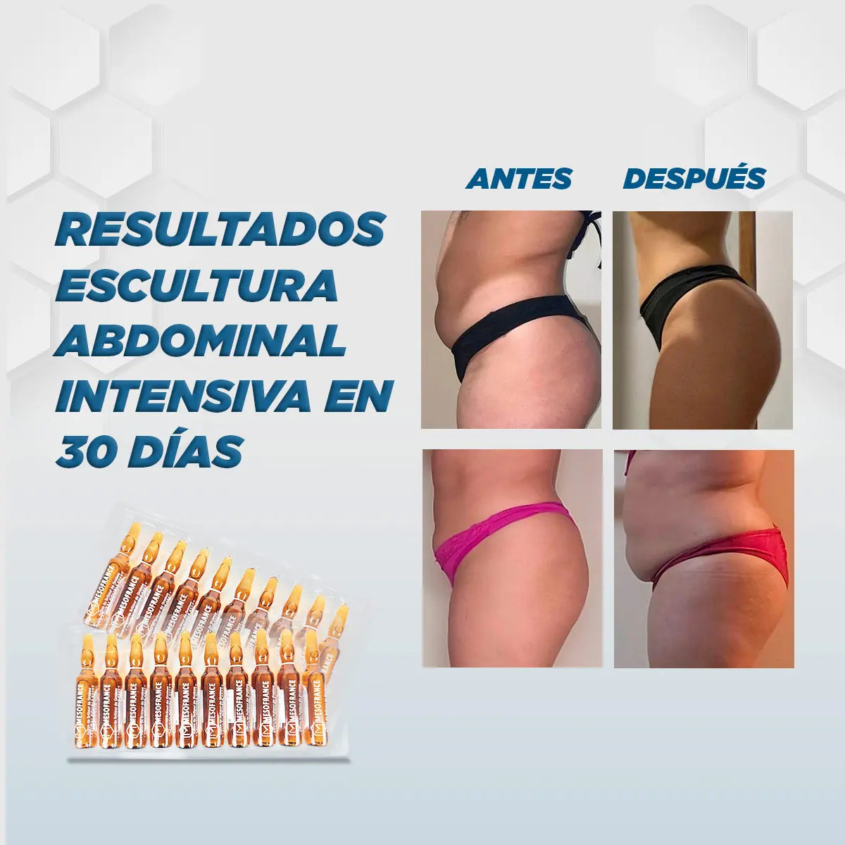 Escultura Abdominal intensiva en 30 días