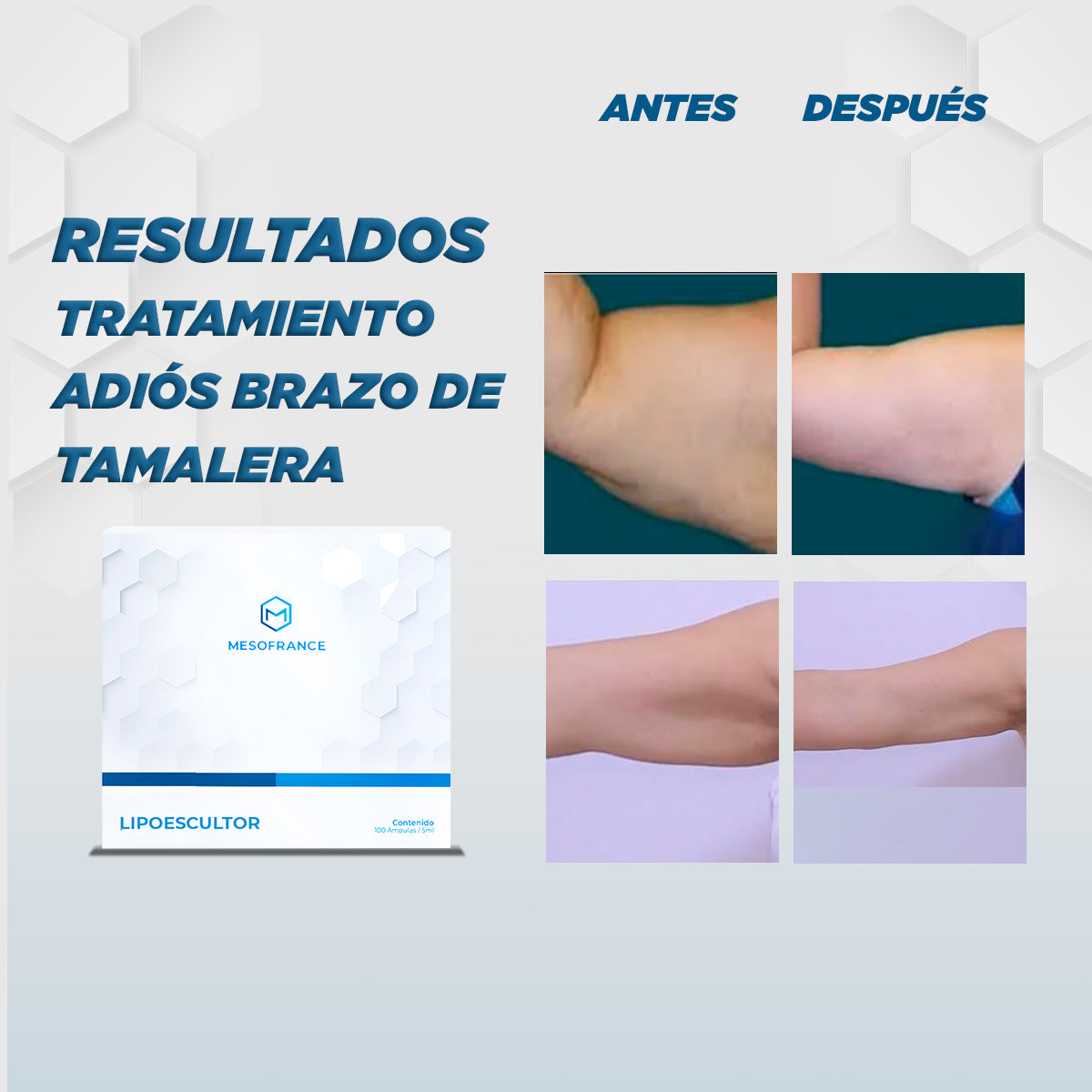 Tratamiento Adiós a los Brazos de Tamalera