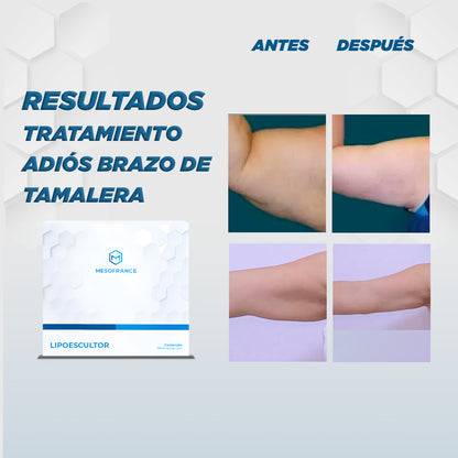 Tratamiento Adiós a los Brazos de Tamalera