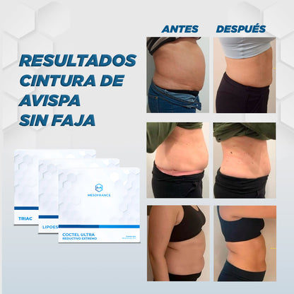 Tratamiento cinturita de avispa sin faja