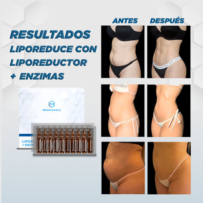 Tratamiento Liporeduce con Liporeductor + Enzimas