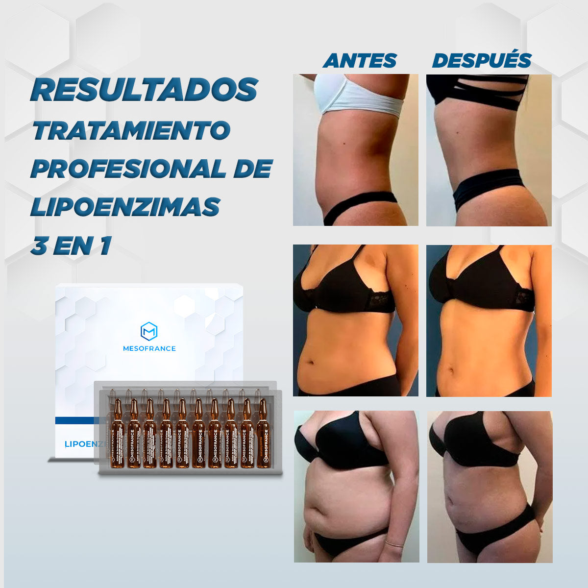 Tratamiento Profesional de Lipoenzimas 3 en 1