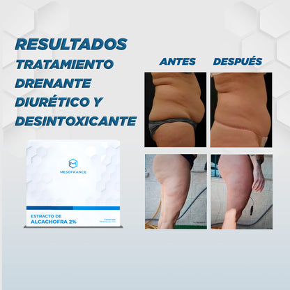 Tratamiento Drenante, Diurético, Desintoxicante