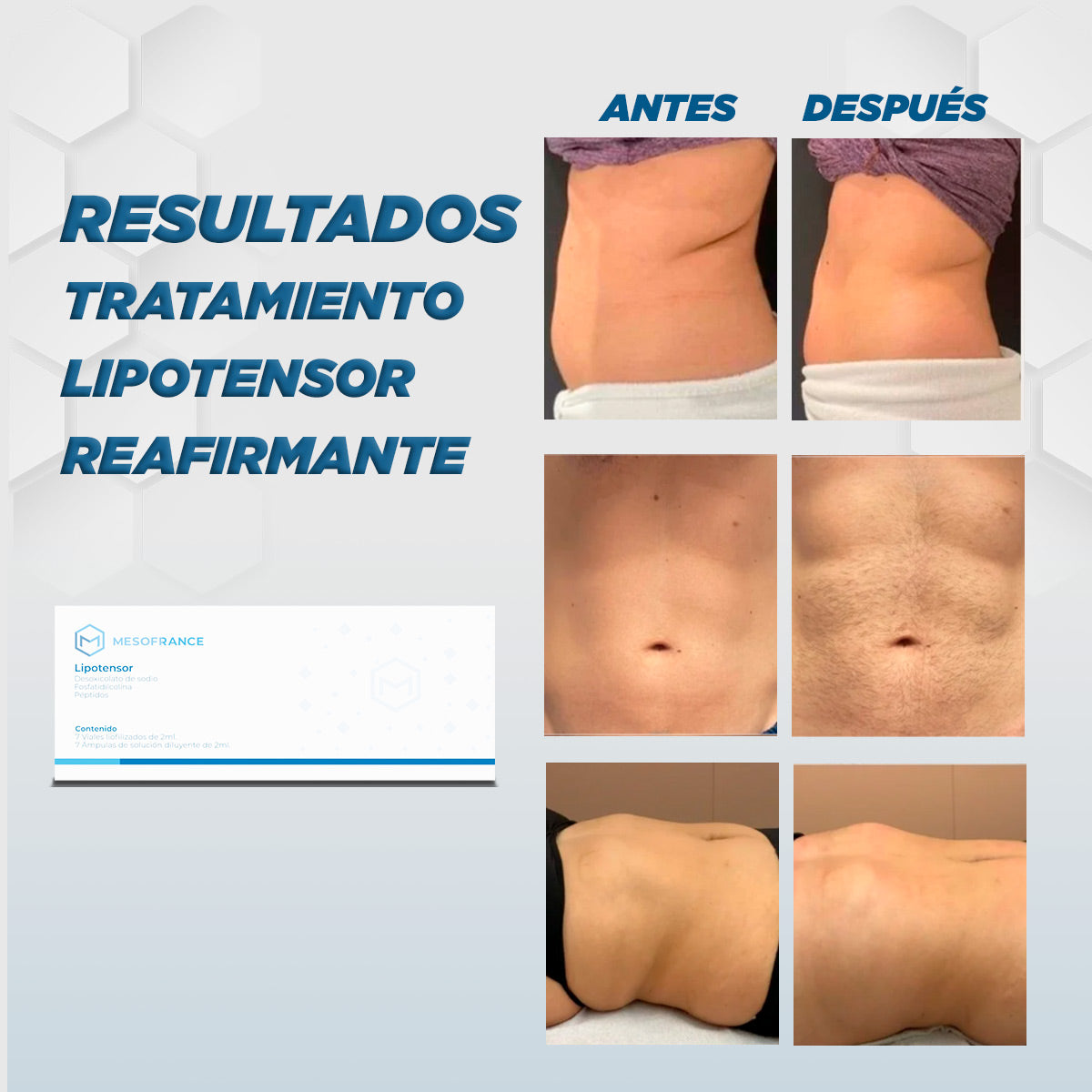Tratamiento Lipotensor Reafirmante